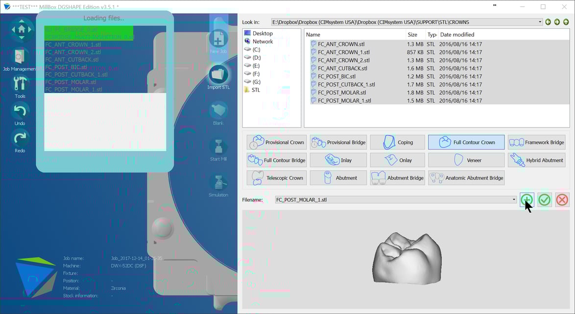 Introducing MillBox A new powerful CAM Interface powered by SUM3D Dental